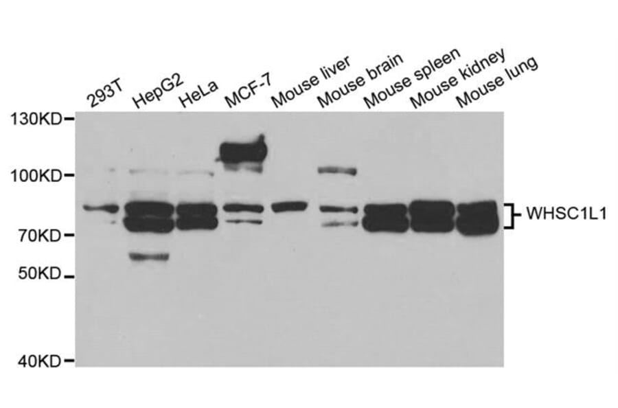 Western blot - WHSC1L1 Antibody from Signalway Antibody (32917) - Antibodies.com