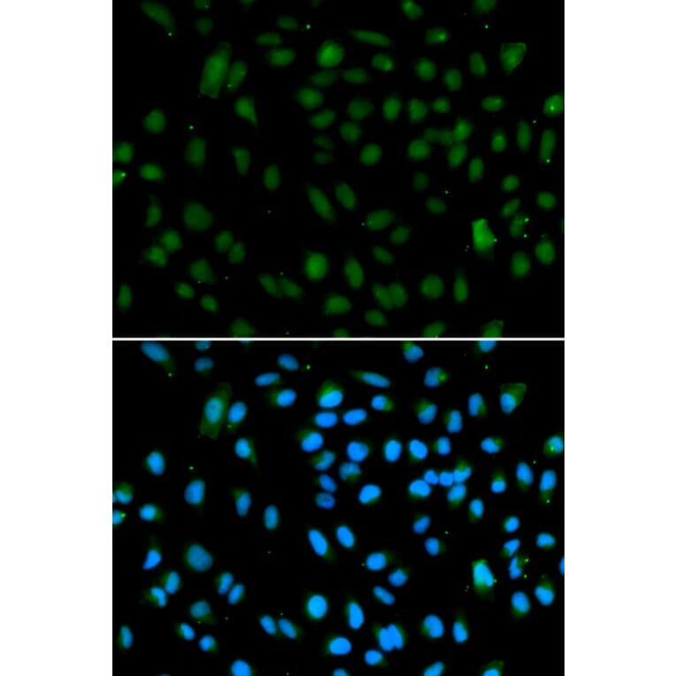 Immunofluorescence - WHSC1L1 Antibody from Signalway Antibody (32917) - Antibodies.com