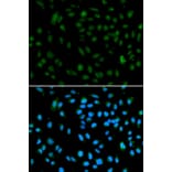 Immunofluorescence - WHSC1L1 Antibody from Signalway Antibody (32917) - Antibodies.com