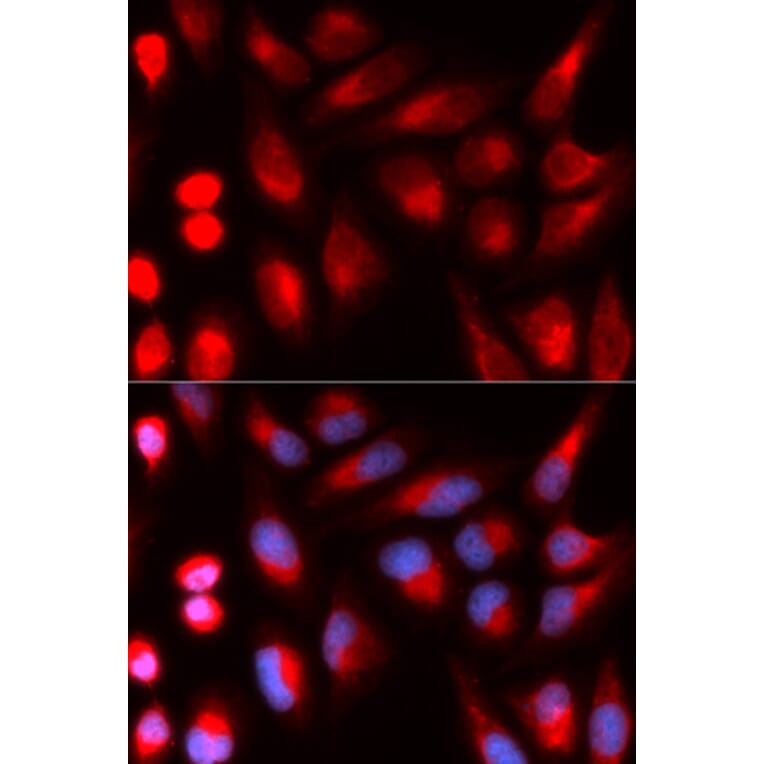 Immunofluorescence - DCLRE1C Antibody from Signalway Antibody (32923) - Antibodies.com