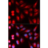 Immunofluorescence - DCLRE1C Antibody from Signalway Antibody (32923) - Antibodies.com