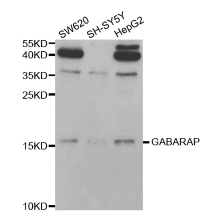 Western blot - GABARAP Antibody from Signalway Antibody (32924) - Antibodies.com