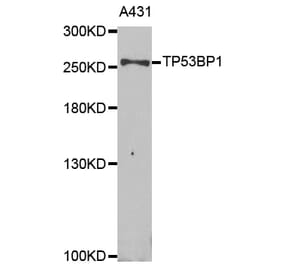 Western blot - TP53BP1 Antibody from Signalway Antibody (33021) - Antibodies.com