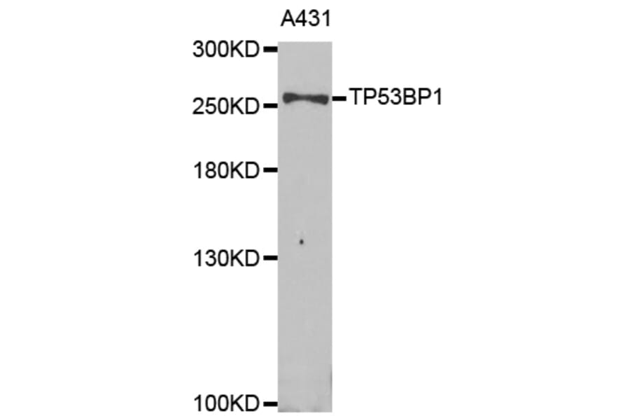 Western blot - TP53BP1 Antibody from Signalway Antibody (33021) - Antibodies.com