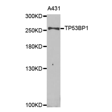 Western blot - TP53BP1 Antibody from Signalway Antibody (33021) - Antibodies.com