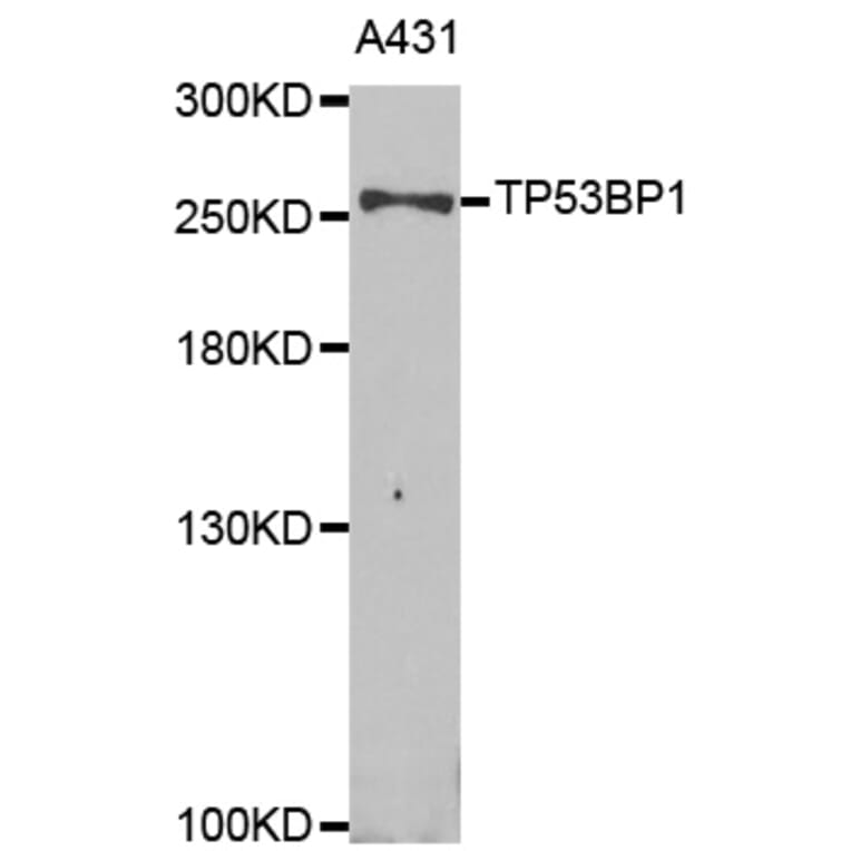 Western blot - TP53BP1 Antibody from Signalway Antibody (33021) - Antibodies.com