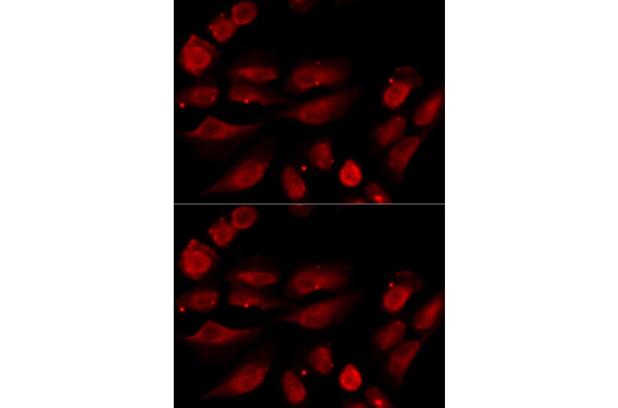 Immunofluorescence - TP53BP1 Antibody from Signalway Antibody (33021) - Antibodies.com
