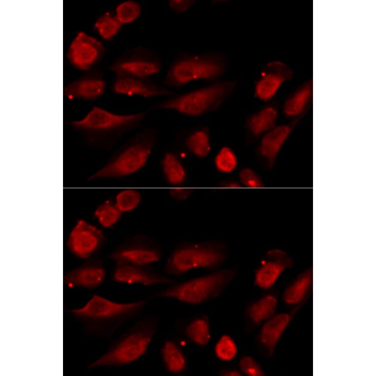 Immunofluorescence - TP53BP1 Antibody from Signalway Antibody (33021) - Antibodies.com