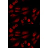 Immunofluorescence - TP53BP1 Antibody from Signalway Antibody (33021) - Antibodies.com