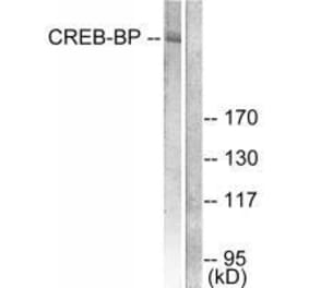 Western blot - CREB-BP Antibody from Signalway Antibody (33346) - Antibodies.com