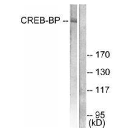Western blot - CREB-BP Antibody from Signalway Antibody (33346) - Antibodies.com