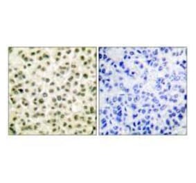 Immunohistochemistry - Ku70/80 Antibody from Signalway Antibody (33425) - Antibodies.com