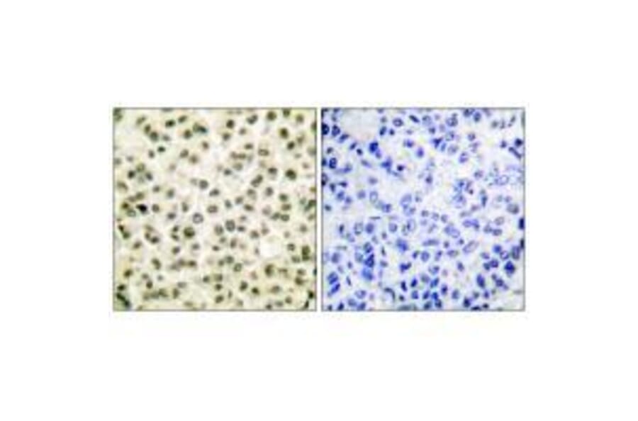 Immunohistochemistry - Ku70/80 Antibody from Signalway Antibody (33425) - Antibodies.com