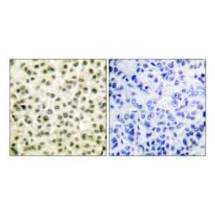 Immunohistochemistry - Ku70/80 Antibody from Signalway Antibody (33425) - Antibodies.com