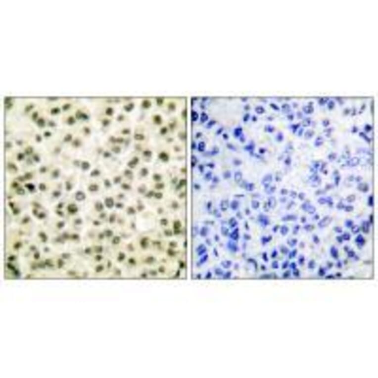 Immunohistochemistry - Ku70/80 Antibody from Signalway Antibody (33425) - Antibodies.com