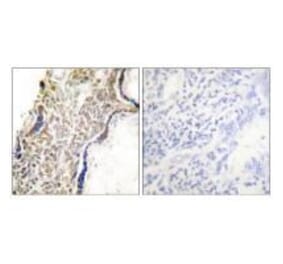 Immunohistochemistry - p14 ARF Antibody from Signalway Antibody (33456) - Antibodies.com