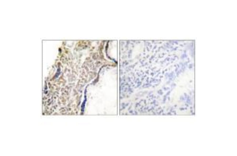 Immunohistochemistry - p14 ARF Antibody from Signalway Antibody (33456) - Antibodies.com