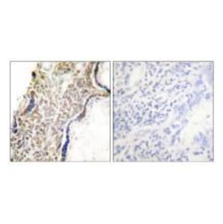 Immunohistochemistry - p14 ARF Antibody from Signalway Antibody (33456) - Antibodies.com