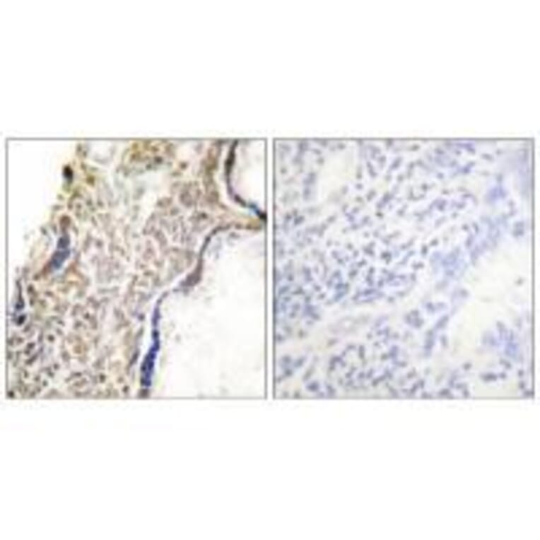 Immunohistochemistry - p14 ARF Antibody from Signalway Antibody (33456) - Antibodies.com