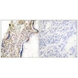 Immunohistochemistry - p14 ARF Antibody from Signalway Antibody (33456) - Antibodies.com