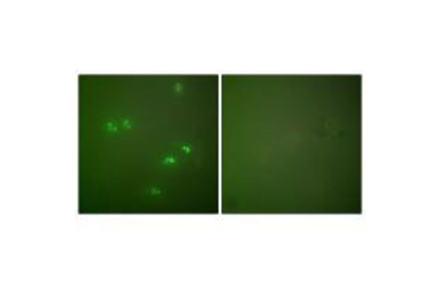 Immunofluorescence - p14 ARF Antibody from Signalway Antibody (33456) - Antibodies.com