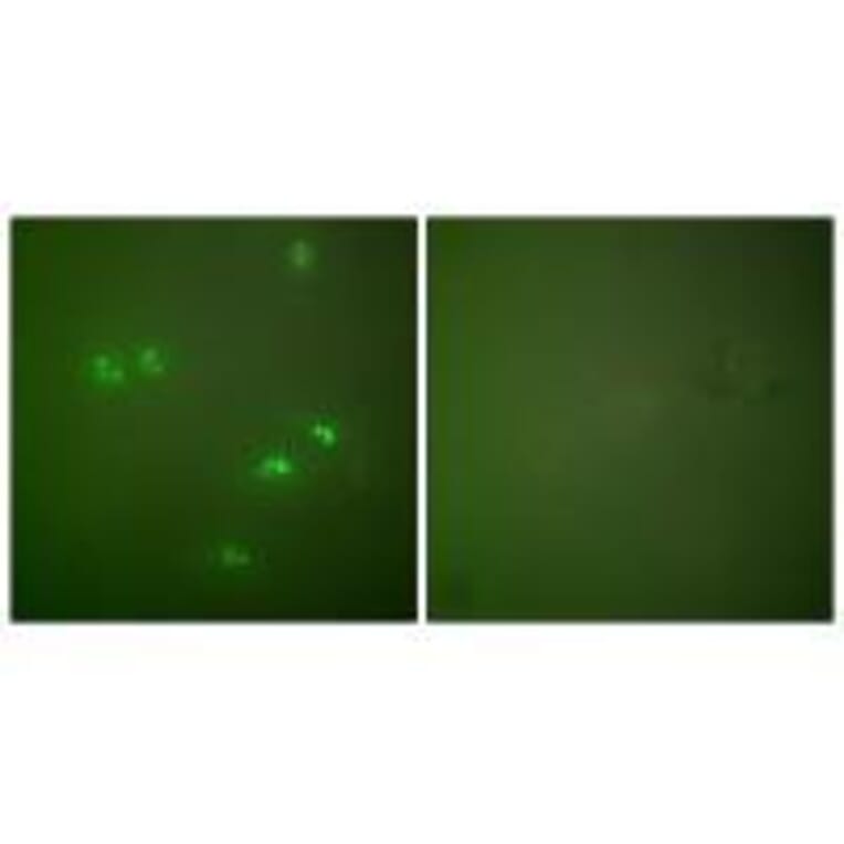 Immunofluorescence - p14 ARF Antibody from Signalway Antibody (33456) - Antibodies.com