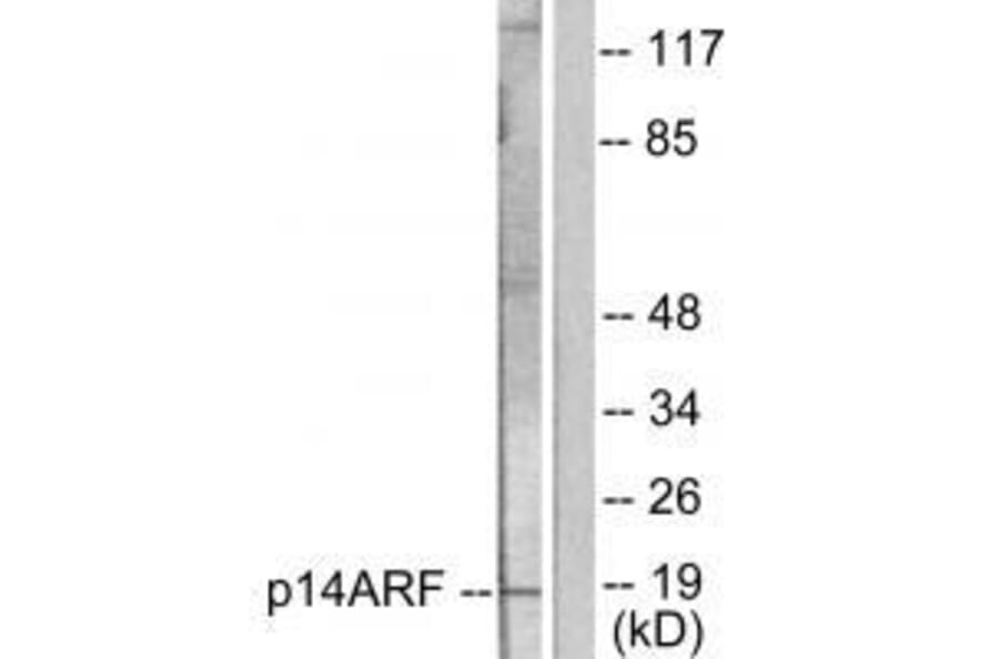 Western blot - p14 ARF Antibody from Signalway Antibody (33456) - Antibodies.com