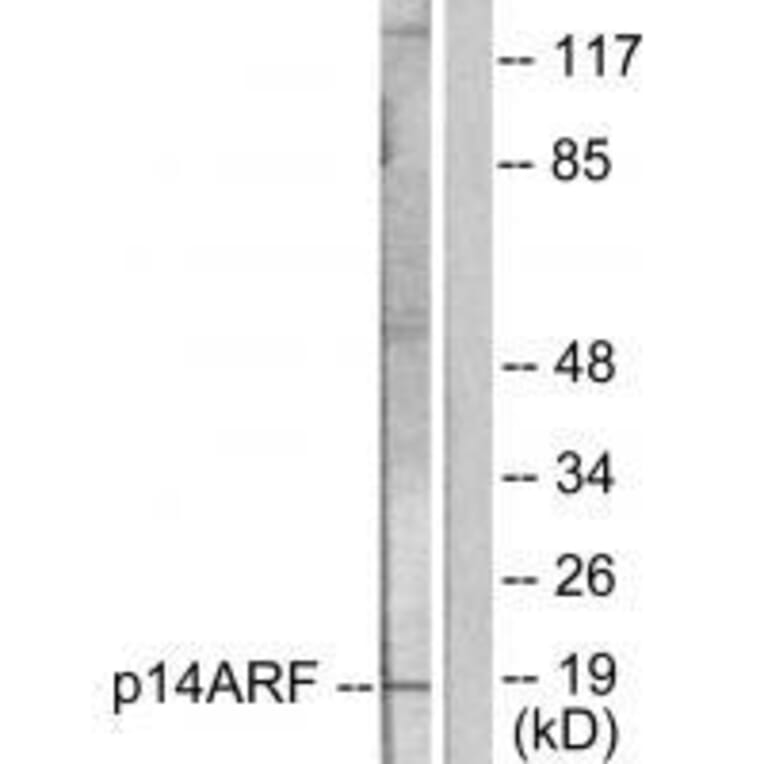 Western blot - p14 ARF Antibody from Signalway Antibody (33456) - Antibodies.com