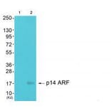 Western blot - p14 ARF Antibody from Signalway Antibody (33456) - Antibodies.com