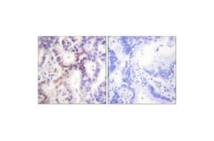 Immunohistochemistry - p15 INK Antibody from Signalway Antibody (33457) - Antibodies.com