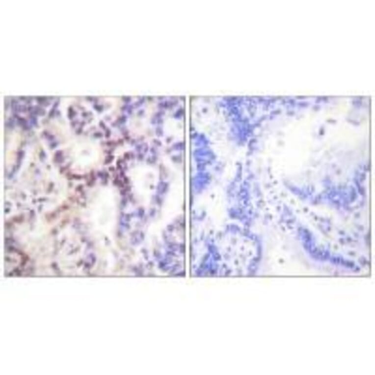 Immunohistochemistry - p15 INK Antibody from Signalway Antibody (33457) - Antibodies.com