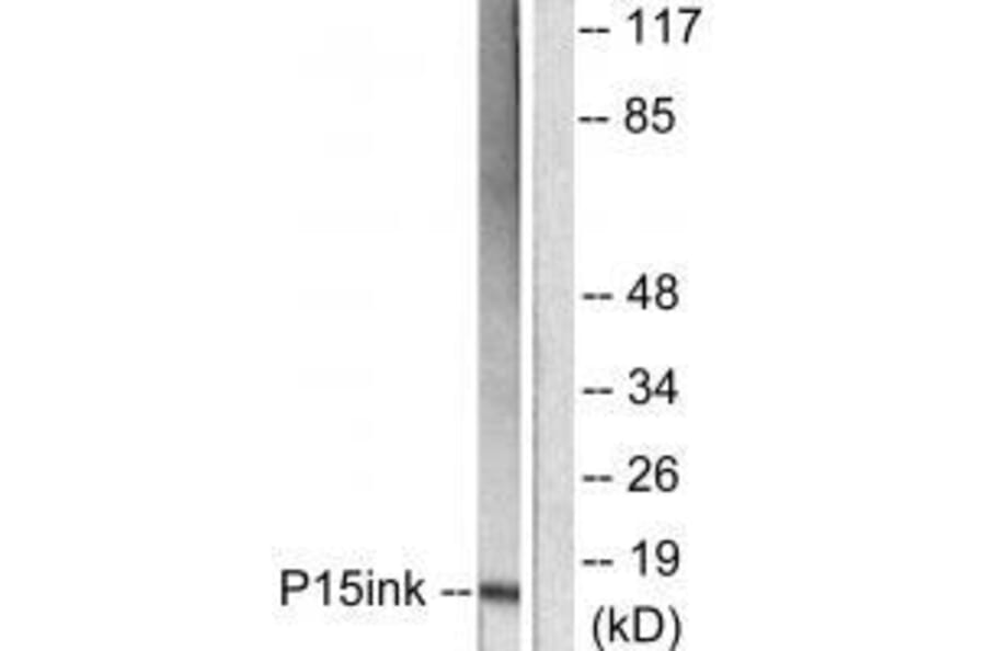 Western blot - p15 INK Antibody from Signalway Antibody (33457) - Antibodies.com