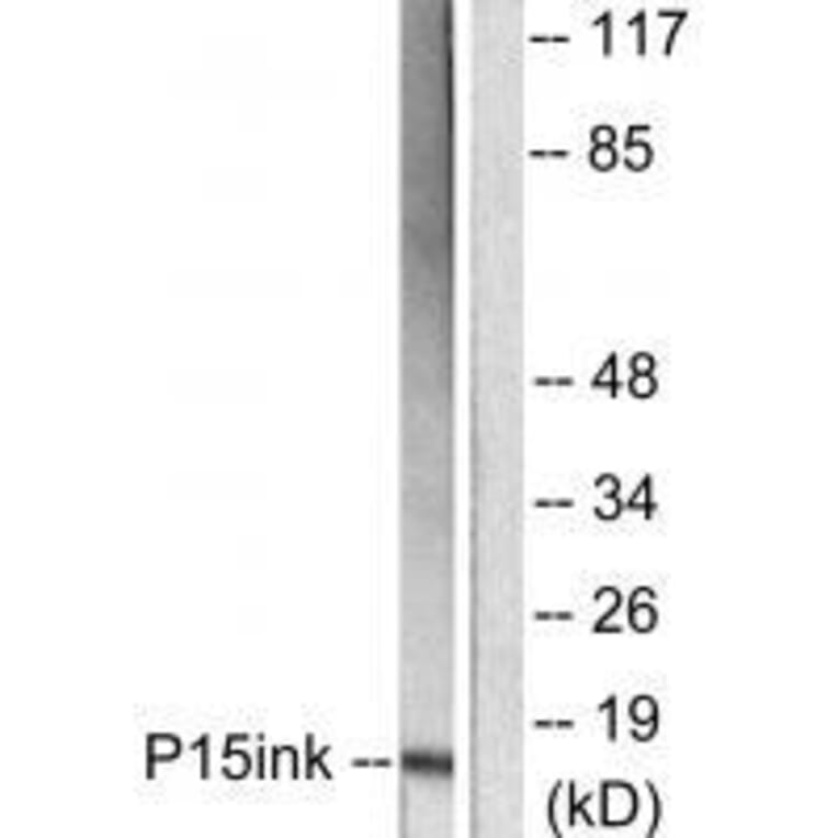 Western blot - p15 INK Antibody from Signalway Antibody (33457) - Antibodies.com