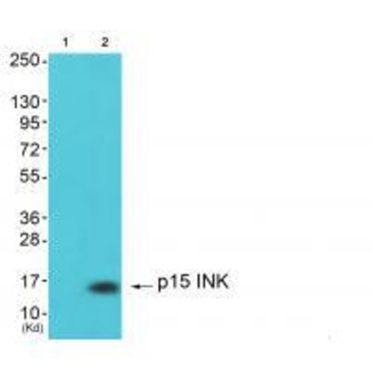 Western blot - p15 INK Antibody from Signalway Antibody (33457) - Antibodies.com