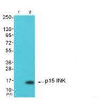 Western blot - p15 INK Antibody from Signalway Antibody (33457) - Antibodies.com