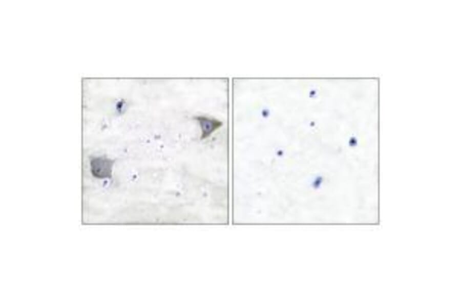 Immunohistochemistry - PDGFR α Antibody from Signalway Antibody (33470) - Antibodies.com