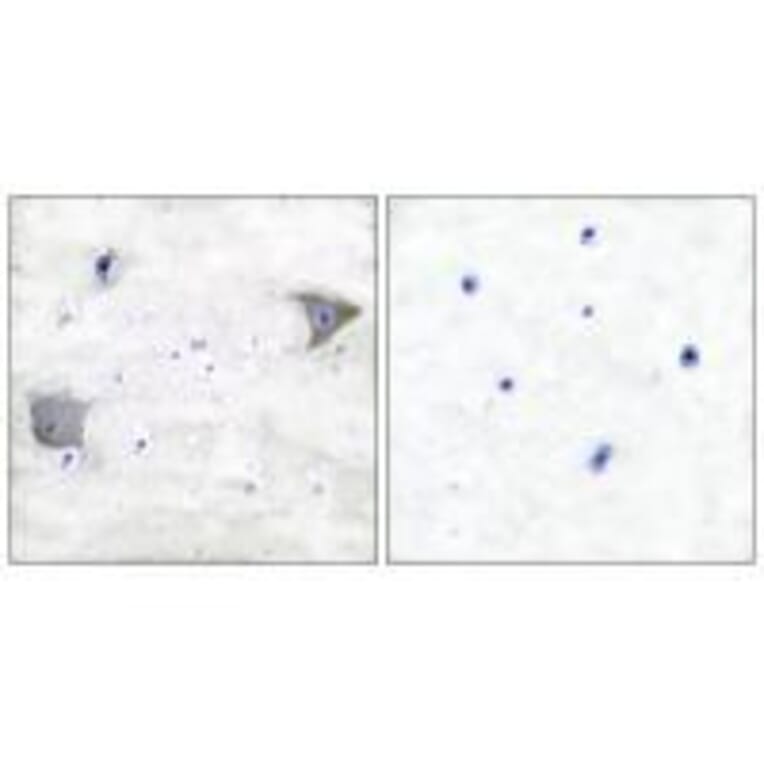 Immunohistochemistry - PDGFR α Antibody from Signalway Antibody (33470) - Antibodies.com