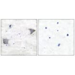 Immunohistochemistry - PDGFR α Antibody from Signalway Antibody (33470) - Antibodies.com