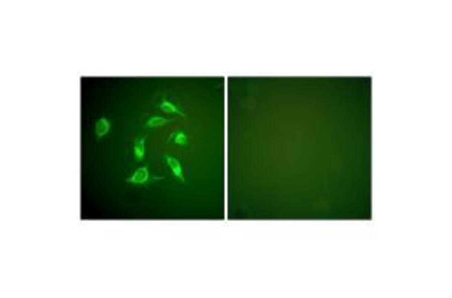 Immunofluorescence - PDGFR α Antibody from Signalway Antibody (33470) - Antibodies.com