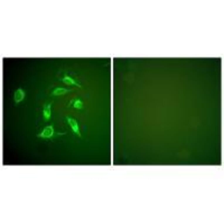 Immunofluorescence - PDGFR α Antibody from Signalway Antibody (33470) - Antibodies.com