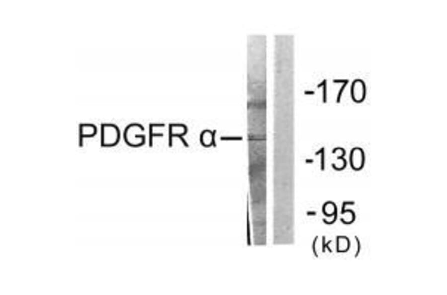 Western blot - PDGFR α Antibody from Signalway Antibody (33470) - Antibodies.com