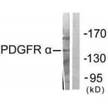 Western blot - PDGFR α Antibody from Signalway Antibody (33470) - Antibodies.com
