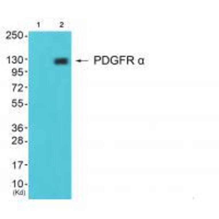 Western blot - PDGFR α Antibody from Signalway Antibody (33470) - Antibodies.com