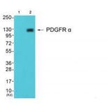 Western blot - PDGFR α Antibody from Signalway Antibody (33470) - Antibodies.com
