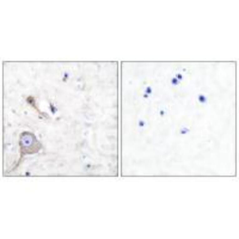 Immunohistochemistry - S100 A1 Antibody from Signalway Antibody (33483) - Antibodies.com
