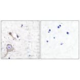 Immunohistochemistry - S100 A1 Antibody from Signalway Antibody (33483) - Antibodies.com