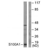 Western blot - S100 A1 Antibody from Signalway Antibody (33483) - Antibodies.com