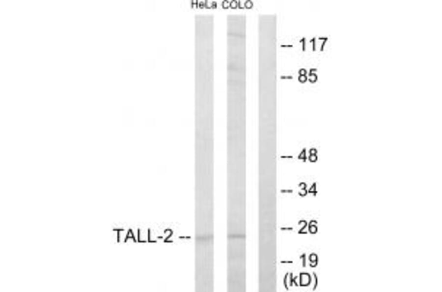 Western blot - TALL-2 Antibody from Signalway Antibody (33618) - Antibodies.com