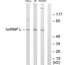 Western blot - hnRNP L Antibody from Signalway Antibody (33682) - Antibodies.com