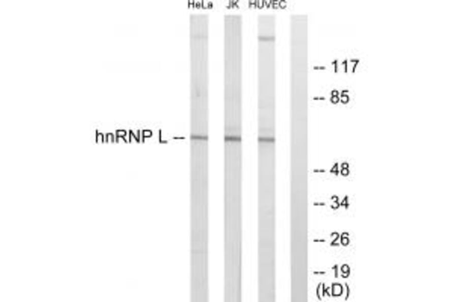 Western blot - hnRNP L Antibody from Signalway Antibody (33682) - Antibodies.com